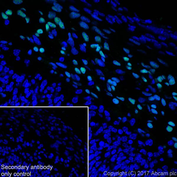 Anti-FOXC1 antibody [EPR20685](ab227977)