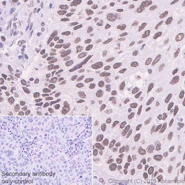 Anti-BRD1/BRL antibody [EPR12960](AB181060)