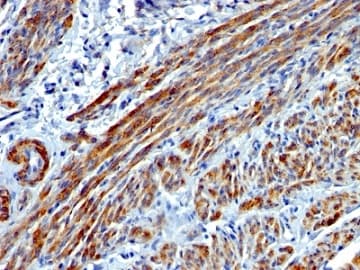 Smooth Muscle Myosin Heavy Chain I Antibody Myh11 923 Ab233940  Immunohistochemistry Formalin Pfa Fixed Paraffin Embedded Sections Img137681