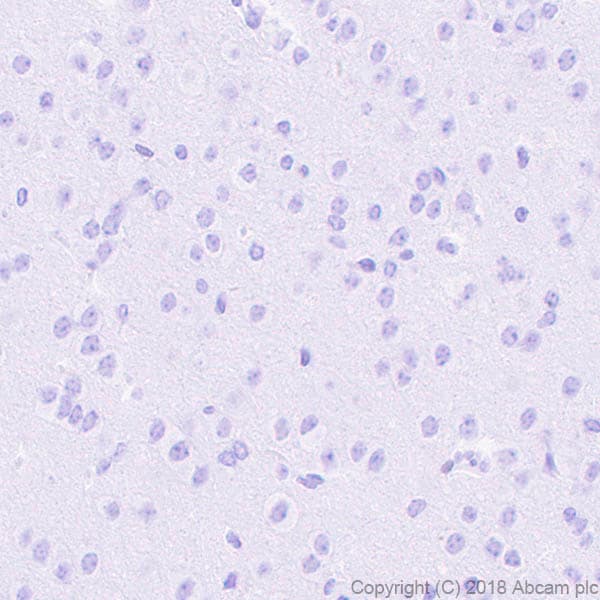 Anti-ETS2 antibody [EPR22419](AB219948)