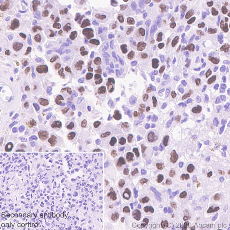 Anti-Histone H3.3 (mutated K36M) antibody [EPR23526-89] - BSA and Azide free(AB277487)