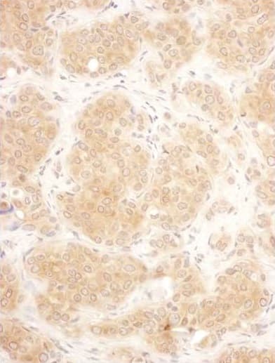 Anti-GART antibody(AB187716)