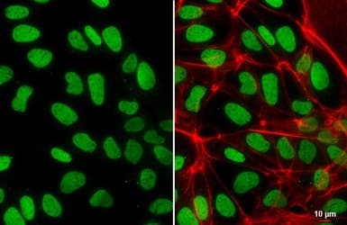 Anti-Histone H2A.Z antibody - ChIP Grade(ab97966)