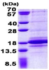 Recombinant Human C1D protein(AB156979)