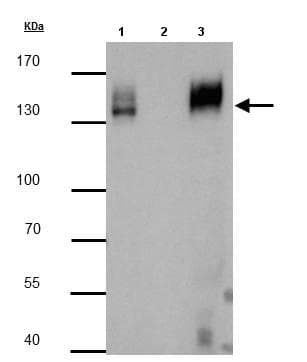 Anti-mCherry antibody(AB183628)