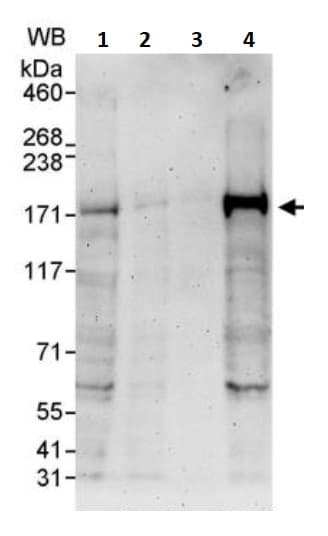 Anti-FANCD2 antibody(AB245347)