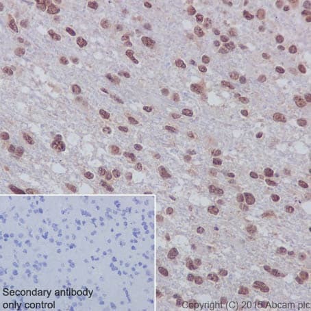 Anti-Huntingtin antibody [EPR5526](AB109115)
