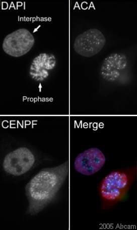 Anti-CENPF antibody(AB5)