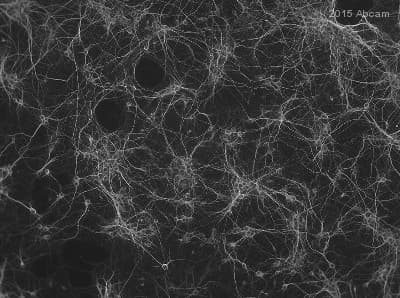 Anti-MAP2 antibody - Neuronal Marker(AB32454)