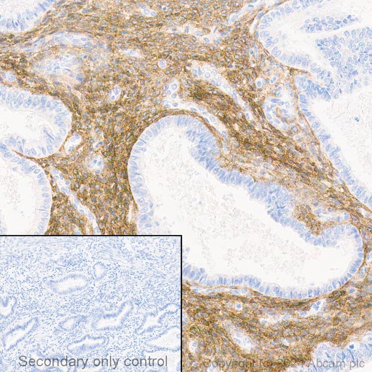 Anti-PDGFR alpha antibody [EPR22059-270](AB203491)