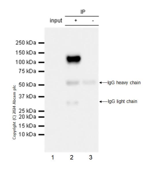 Anti-Adenovirus Type 5 Hexon antibody [EPR28237-57](AB316852)