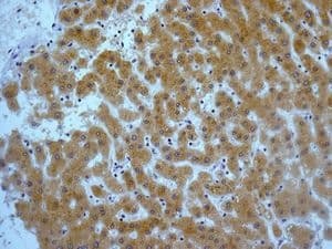Cyp2c19 Antibody Epr6576 Ab137015  Immunohistochemistry Formalin Pfa Fixed Paraffin Embedded Sections Img25525