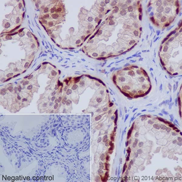 Hsp70 Antibody Epr17677 Ab182844  Immunohistochemistry Formalin Pfa Fixed Paraffin Embedded Sections Img30120