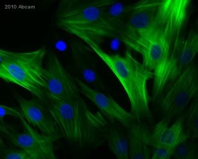 Anti-Calponin 1 antibody [EP798Y](AB46794)