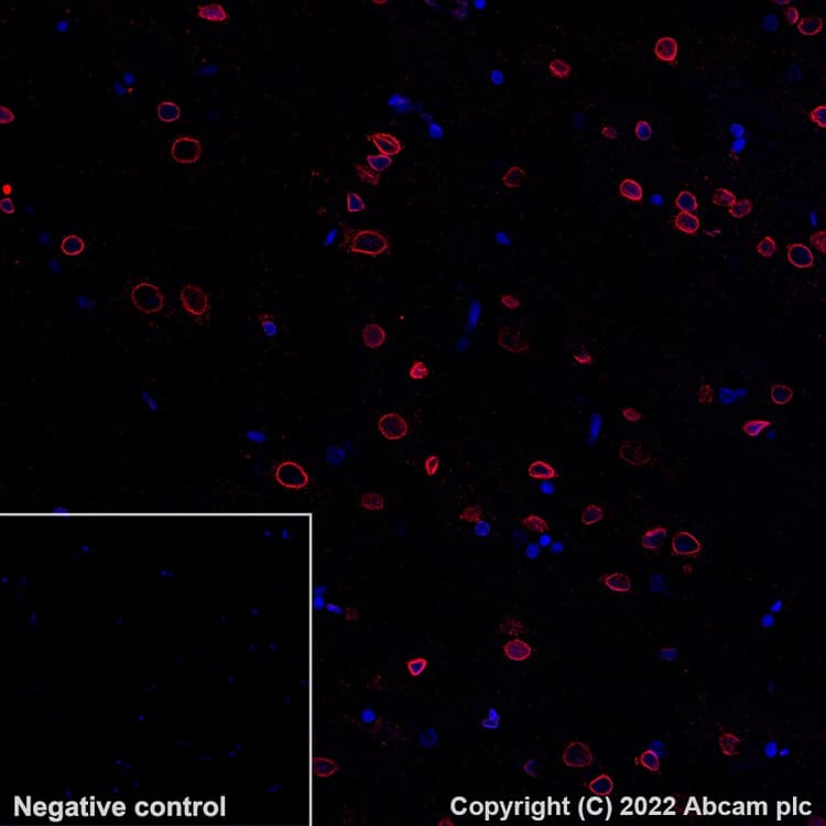 Alexa Fluor® 647 Anti-Lamin B2 antibody [EPR9701(B)](AB200427)