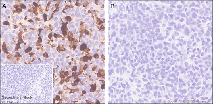 Anti-RFP antibody [EPR28246-45](AB314225)