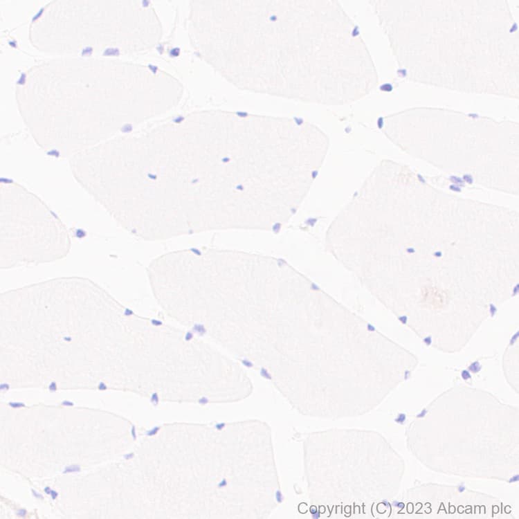Anti-VSV-G tag antibody [EPR28362-204](AB309106)