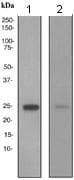 Rbp4 Antibody Ep3657 Ab109193  Western Blot Img131536