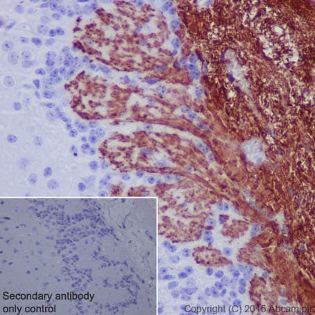 Olfactory Marker Protein Omp Antibody Epr19190 Bsa And Azide Free Ab250712  Immunohistochemistry Formalin Pfa Fixed Paraffin Embedded Sections Img12697