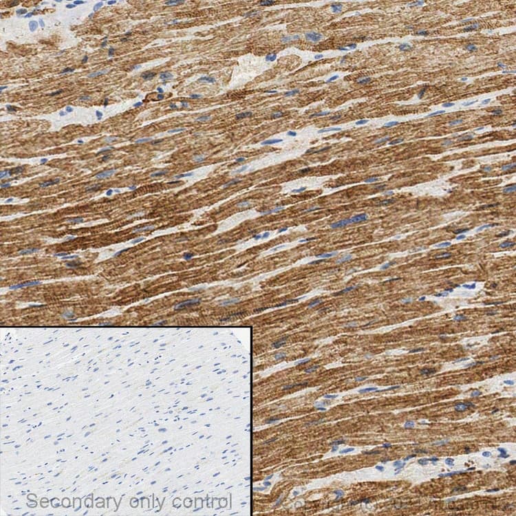 Anti-Cardiac Troponin T antibody(AB45932)