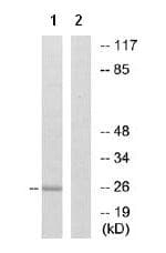 Itga7 Antibody Ab75224  Western Blot Img6215