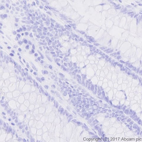 Anti-nkx6.1 antibody [EPR20405] - BSA and Azide free(AB240398)