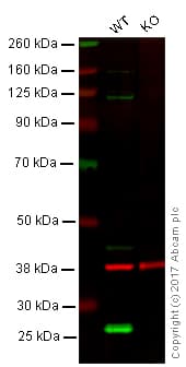 Anti-PGP9.5 antibody [13C4 / I3C4](AB8189)