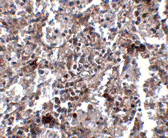 Kctd15 Antibody Ab106373  Immunohistochemistry Formalin Pfa Fixed Paraffin Embedded Sections Img124968