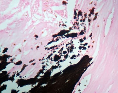 Von Kossa Stain Kit (Calcium Stain)(AB150687)