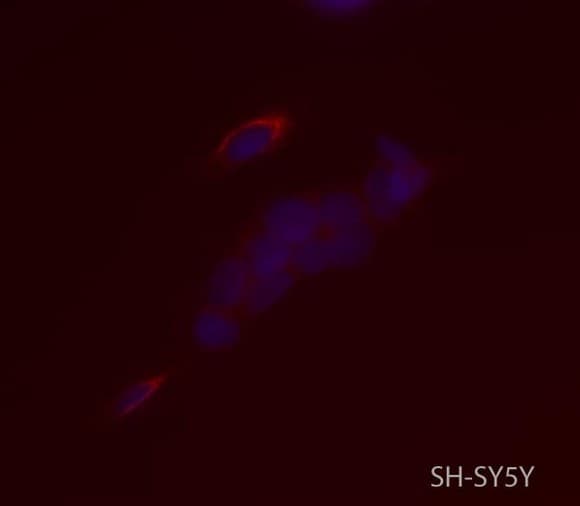 Anti-SYT2 antibody [ZNP-1](AB154035)