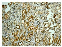 Capzb Antibody Epr10236 Ab175212  Immunohistochemistry Formalin Pfa Fixed Paraffin Embedded Sections Img88196