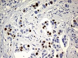 Anti-Ki67 antibody [OTI5D7](AB156956)