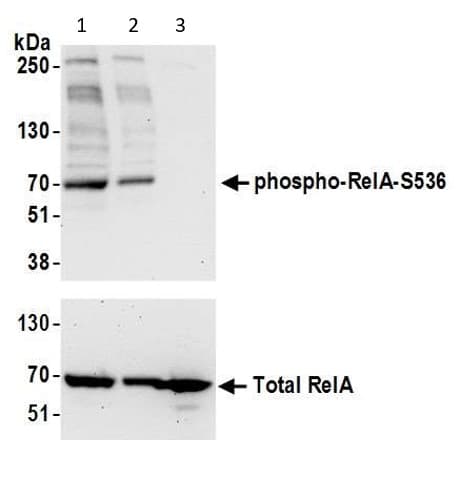 Anti-NF-kB p65 (phospho S536) antibody(AB86299)