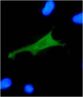 Anti-HPV18 E7 antibody [8E2](AB100953)