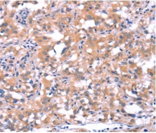 Anti-FAT/FAT1 antibody(AB198892)