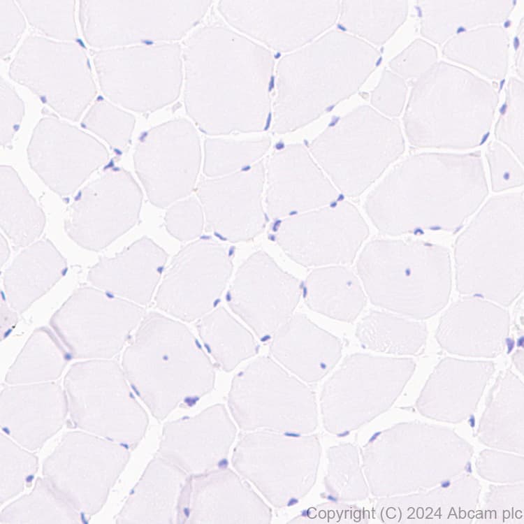 Anti-Slc25a1 antibody [EPR29193-92](AB318201)