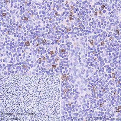 Anti-Granzyme B antibody [EPR8260](AB134933)