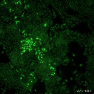 Anti-mCherry antibody(AB205402)