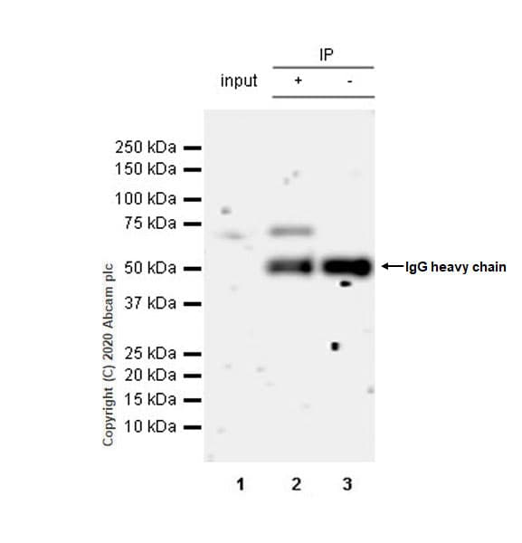 Anti-PHD finger protein 1/PHF1 antibody [EPR14222](AB184951)