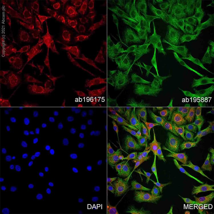 Alexa Fluor® 647 Anti-S100 beta antibody [EP1576Y] - Astrocyte Marker(AB196175)
