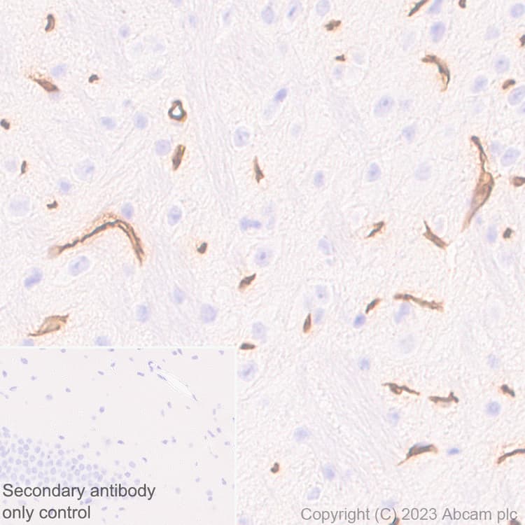 Anti-Ly6c antibody [EPR27220-23](AB314120)