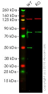 Anti-Transcription factor AP-2-alpha antibody [EPR2688(2)](AB108311)