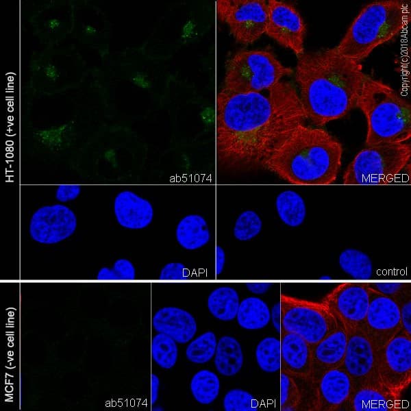 Anti-MMP14 antibody [EP1264Y](AB51074)