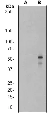 Anti-SMAD3 (pS423/425) + SMAD5 (pS463/465 ) + SMAD1 (pS463/465) + SMAD2 (pS465/467) antibody [EP823Y](AB52903)