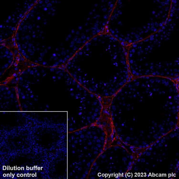 Alexa Fluor® 594 Anti-Collagen I antibody [EPR24331-53](AB313351)