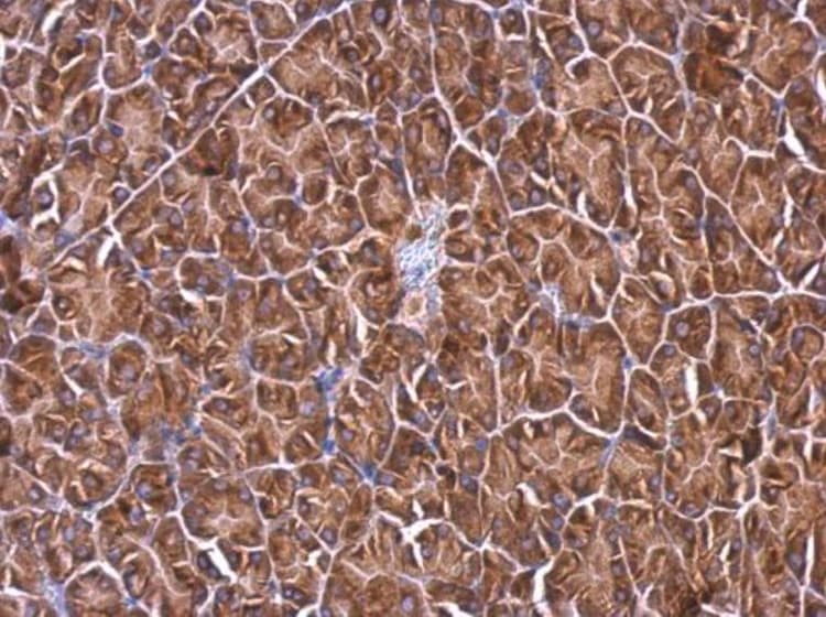 Rpl4 Antibody Ab154907  Immunohistochemistry Formalin Pfa Fixed Paraffin Embedded Sections Img65138