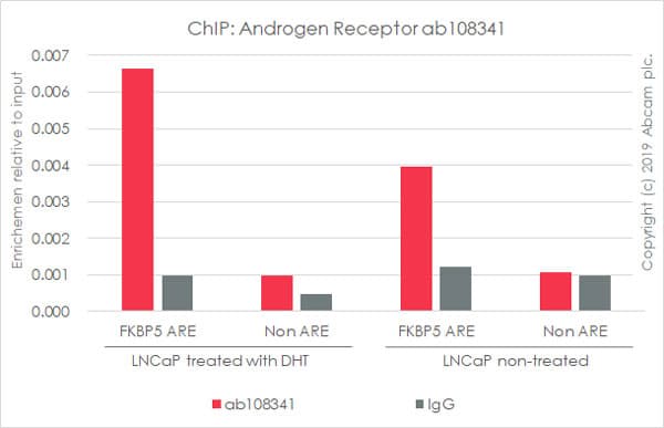 Anti-Androgen Receptor antibody [ER179(2)] - ChIP Grade(AB108341)
