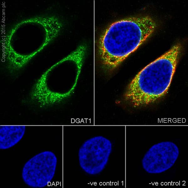 Anti-DGAT1 antibody [EPR13430](AB178711)