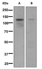 Anti-CtIP antibody [EPNCIR160](AB155988)