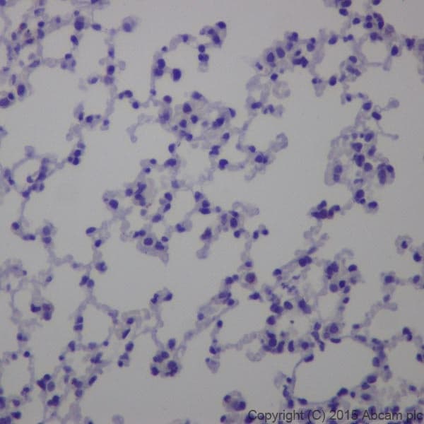 Anti-GAD65 + GAD67 antibody [EPR19366](AB183999)